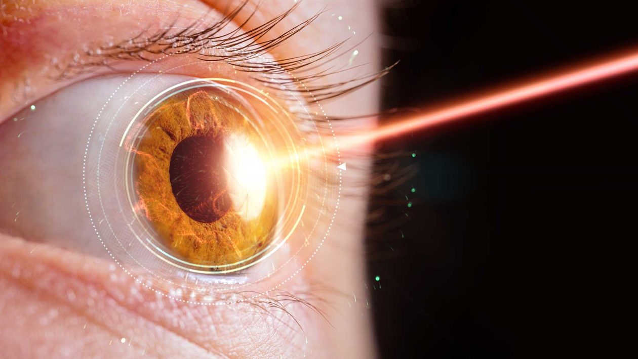 Contactlenzen
