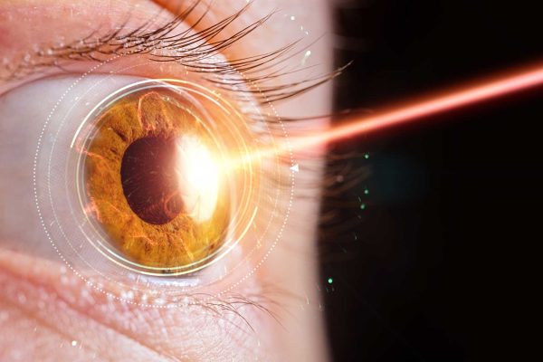Contactlenzen